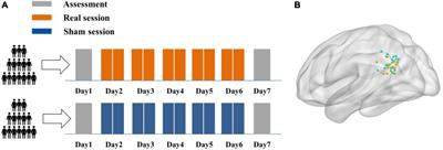 Efficacy of twice-daily high-frequency repetitive transcranial magnetic stimulation on associative memory